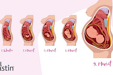 Lage Darm in der Schwangerschaft 